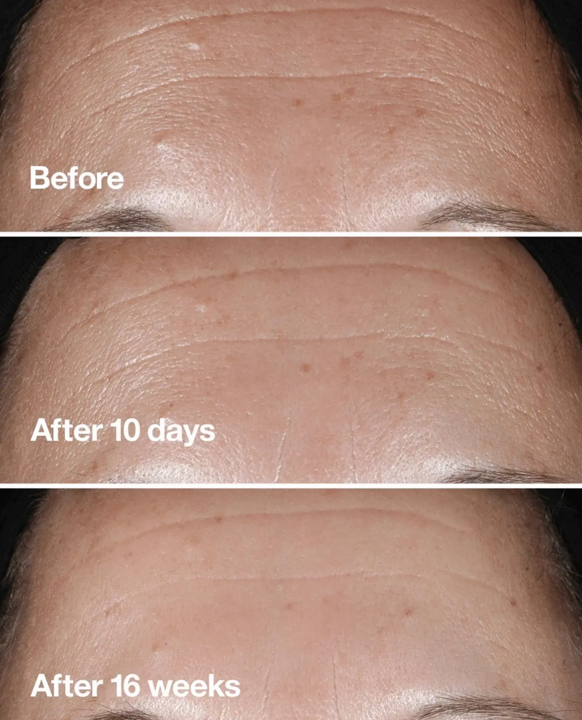 Clinique Smart Clinical Repair Seerumi 50 ml
